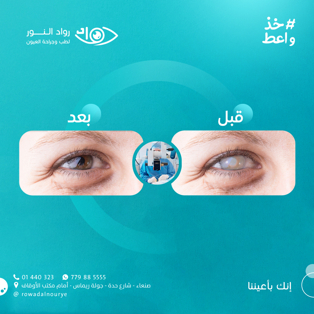 لا تخاف من الاسم ... المياه البيضاء